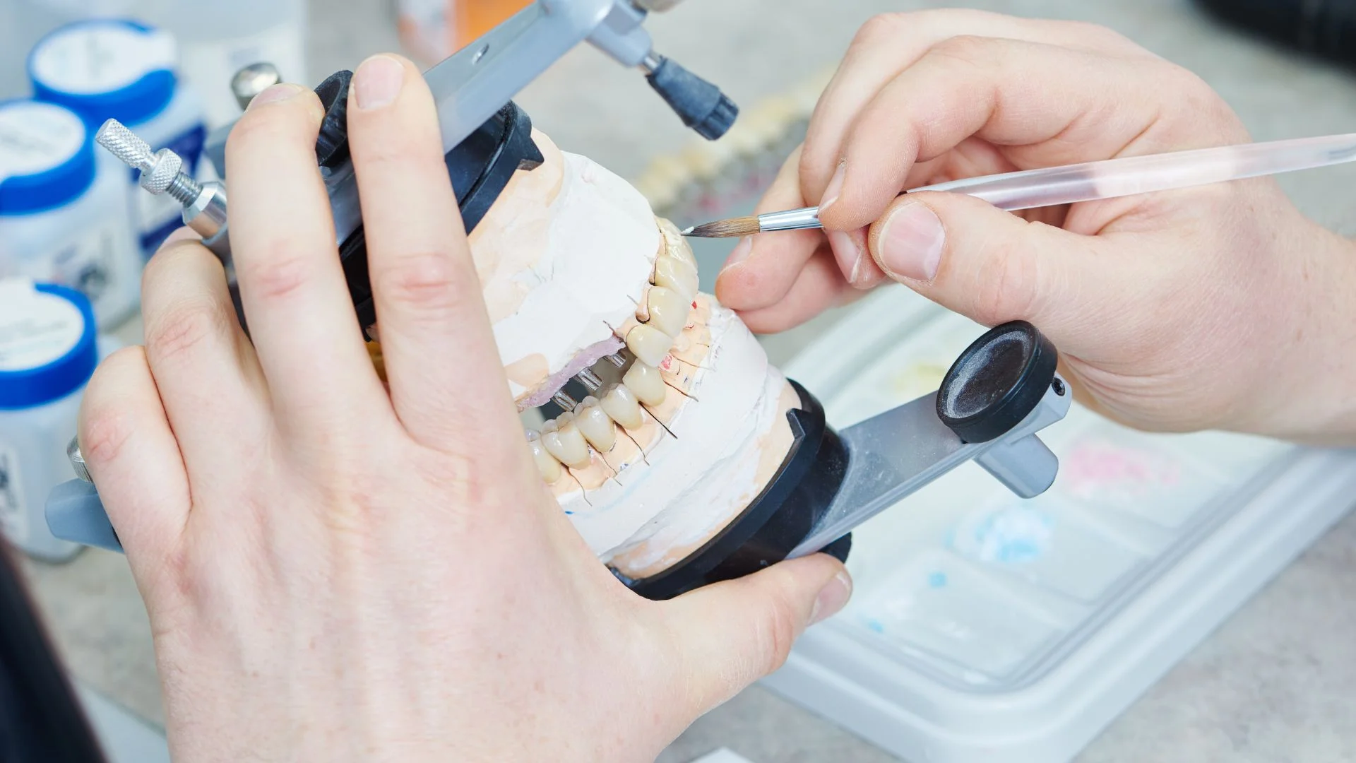 protesis dentales (2)